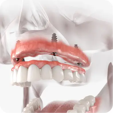 Restorative dentistry graphic